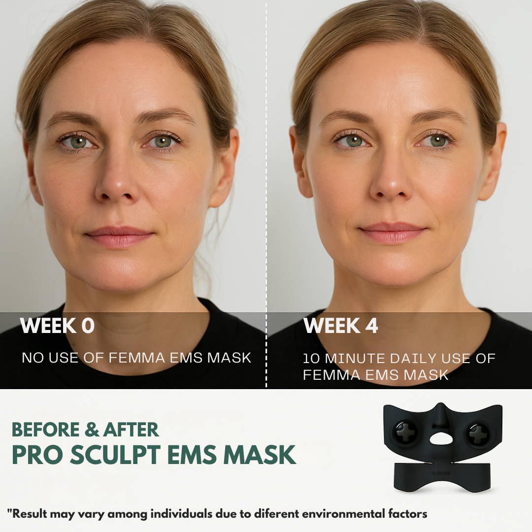 Femma Pro Sculpt™ EMS Face Lifting System